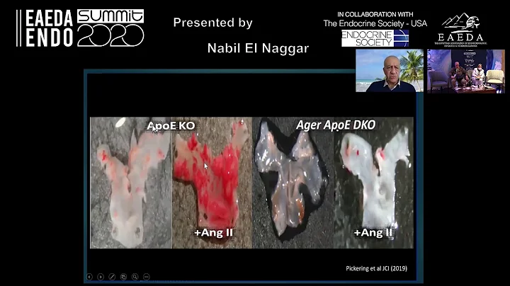 Nabil El Naggar Rage    Beyond the usual