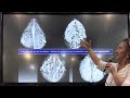 Correlación mamo ecográfica - Taller integrador de imágenes