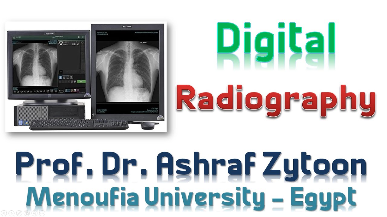 Dark Room (6) Digital Radiography الغرفة المظلمة للأشعة التشخيصية (الأشعة الرقمية) YouTube