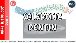 Sclerotic Dentin | Transparent Dentin | Translucent Dentin | Dr Paridhi Agrawal
