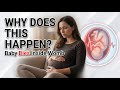 Why Babies Die Inside the Womb | Stillbirth Explained Simply #MaternalHealth #Stillbirth #Pregnancy