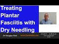 Dry Needling for Plantar Fasciitis | Seattle Podiatrist
