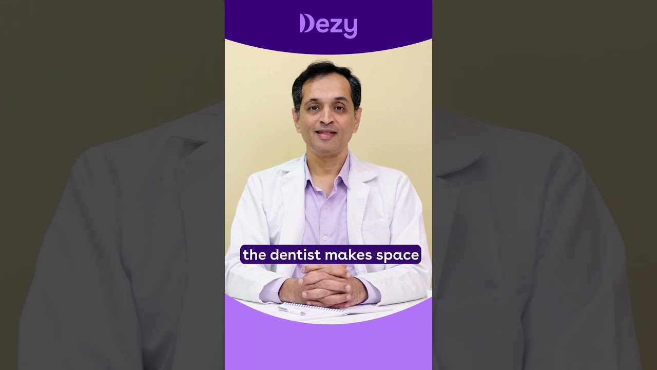 How Does the Dental Implant Procedure Work? - Dezy Dental