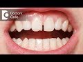 What is frenectomy Why your child might need one Dr. Kamalesh Selvam