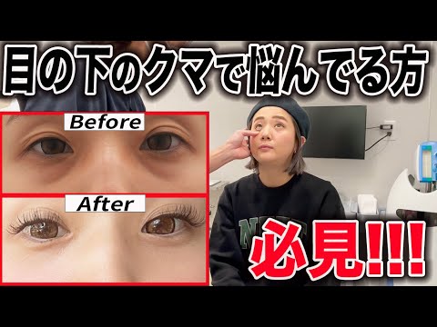 目の下のクマに悩んでる方必見！！