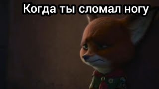 Когда ты сломал ногу