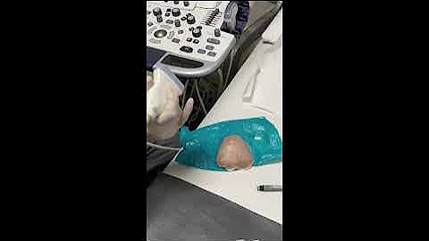 How to do and practice ultrasound guided biopsy