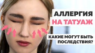 Может ли быть аллергия на татуаж? Что делать если появилась аллергия после татуажа бровей, губ, век