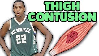 Doctor Explains Khris Middleton Thigh Contusion and Season Ending Complication that Could Develop
