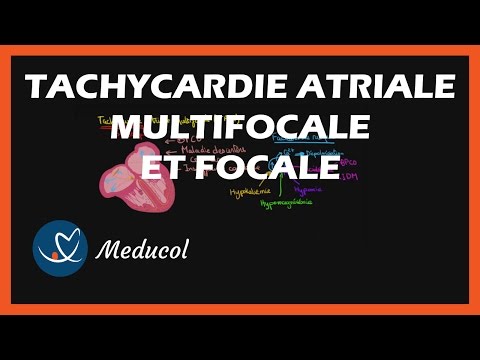 Tachycardie Atriale Multifocale et Tachycardie Atriale Focale: Physiopathologie, symptômes et ECG