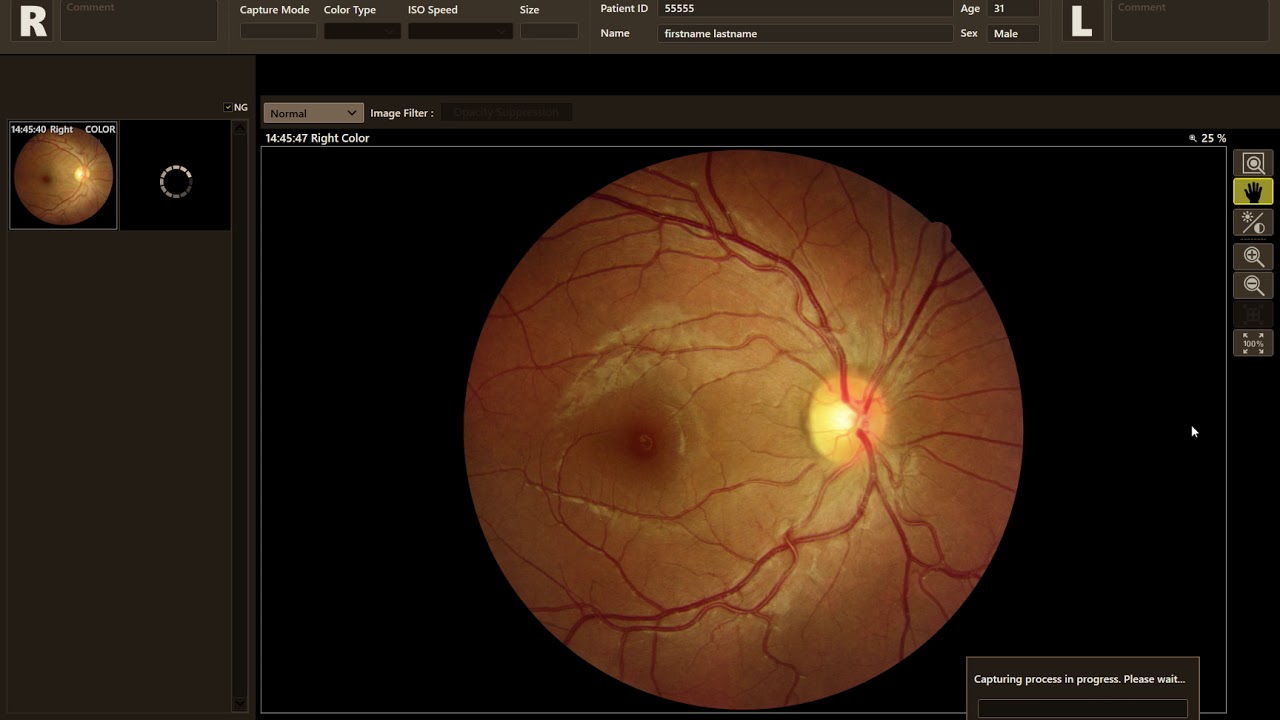 OSP RX integration - CANON - YouTube