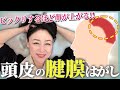 【シワ・たるみケア】目がぱっちり！1日1分の簡単頭皮マッサージですっきり♪【40代50代】