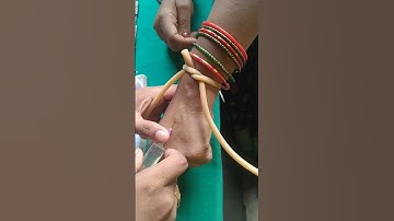 Insert iv injection#shorts #veins #viral #injection