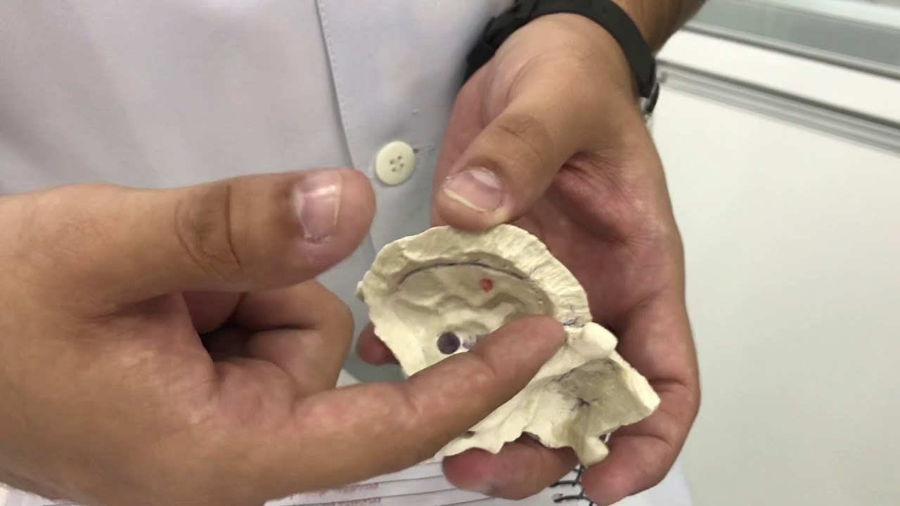 Osso Temporal - Rodrigo