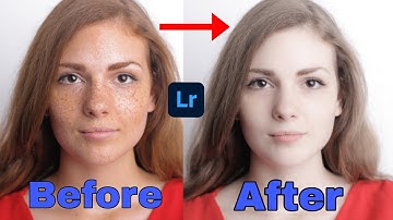 Face Retouching | Pimple Remove In Lightroom | In 2 Minutes | With Just One Tool |
