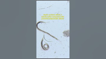 How human parasites respond to garlic | TULO - Microscope