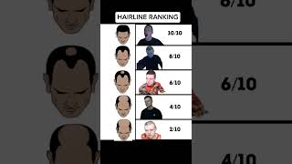 HAIRLINE RANKING #memes