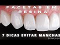 🔴 7 DICAS PARA NÃO MANCHAR SUAS FACETAS EM RESINAS❗️🤯