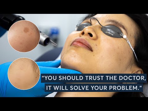 The First Treatment That Helped My Pigmentation.... | London