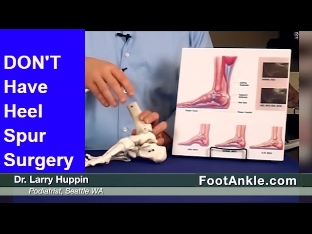 Heel Spur Treatment Near Me: Ankle & Foot Centers of Georgia - West Cobb:  Podiatric Surgeons and Foot & Ankle Specialists