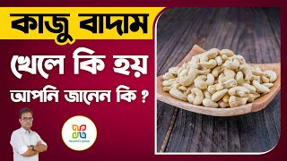 কাজুবাদাম খেলে কি হয় আপনার জানা উচিত। Merits and Demerits of Cashew Nuts. @HealthCription.