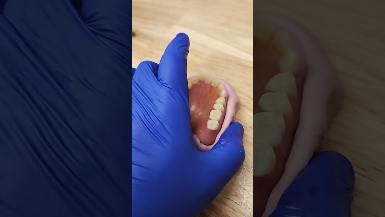 denture repair part 1#dental #denture #dentallab #denturist