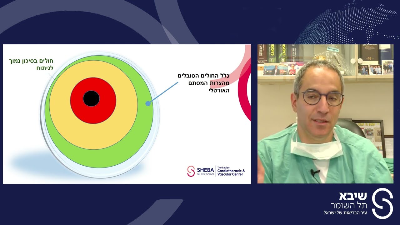 החלפת מסתם אאורטלי בצנתור | שיבא - לב