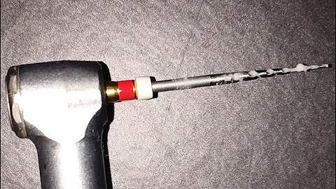 Criteria for root canal width preparation.  How much apical preperation is sufficient during RCT??