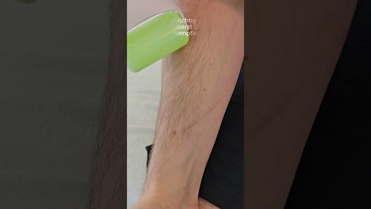 Narbenroller richtig anwenden: So verbesserst Du Deine Narbenpflege!