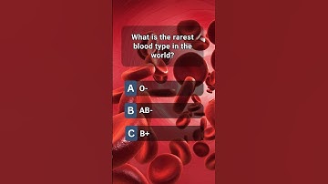 Can you guess the answer? | #shorts #quiztime #quizchallenge #triviaquiz