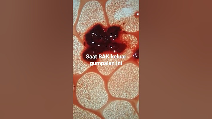 WAKTU KENCING KELUAR GUMPALAN DARAH