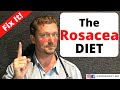 ROSACEA diet (Reverse the Redness) 2020