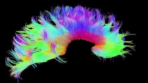 Peering inside a human brain map