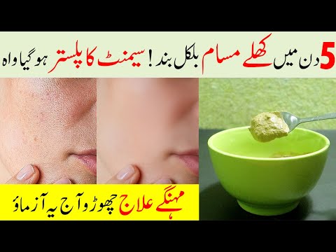 How to Reduce Pores on Face Permanently || Get Rid Of Large Pores Instantly