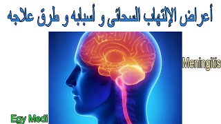 أعراض الالتهاب السحائى 