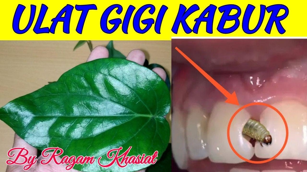 100% MUJARAB!!Sakit Gigi Sembuh Dalam Hitungan Menit 