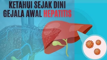 Kenali Gejala Awal Penyakit Hepatitis yang Sering Diabaikan