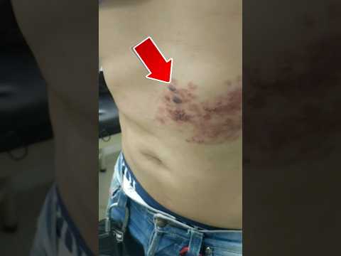 ألم صعب جدا دكتور مصطفى Viral Shorts