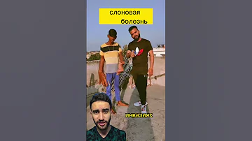 дядя, зачем тебе такие большие руки? или слоновая болезнь
