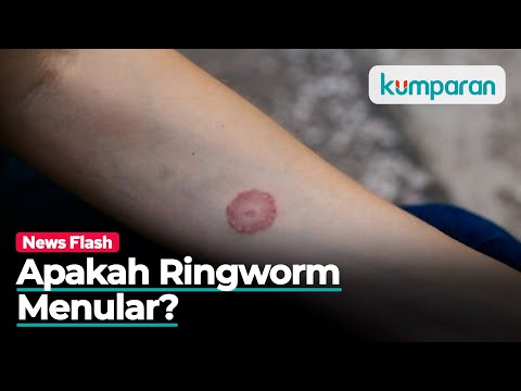 Video: Apakah kurap merupakan infeksi jamur?