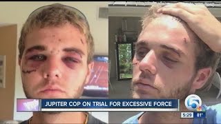 Jupiter officer on trial for aggravated battery