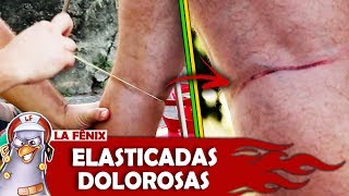 Doloroso alvo