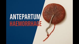 Antepartum Hemorrhage Demystified: Placenta Previa & Abruptio Placentae🎙️
