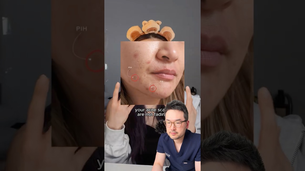 PIE и PIH важно лечить, но это не шрамы 😑 