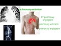 Pulmonary embolism;symptom,diagnosis &amp; management