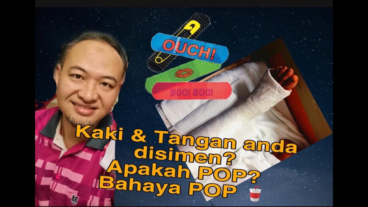 Adakah kaki dan tangan anda disimen? Apakah Plaster of Paris (POP)?