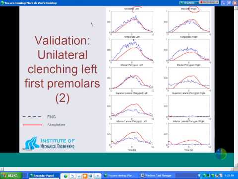 [Webcast] Validation of