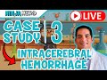 Case Study #3: Intracerebral Hemorrhage