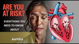 Aortitis Explained Causes, Symptoms and Treatment, All Insights