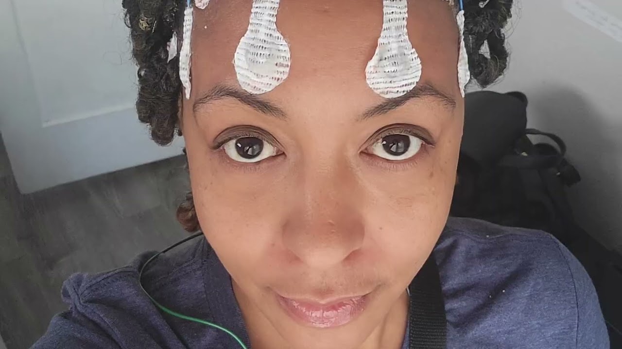 “My Journey With Functional Neurological Disorder (FND): From Struggle to Healing”